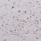 Anti-QDPR Antibody