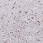 Anti-QDPR Antibody