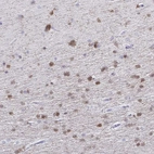 Anti-QDPR Antibody