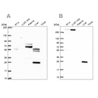 Western blot analysis using Anti-QDPR antibody HPA058951 (A) shows similar pattern to independent antibody HPA065649 (B).