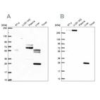 Western blot analysis using Anti-QDPR antibody HPA058951 (A) shows similar pattern to independent antibody HPA065649 (B).