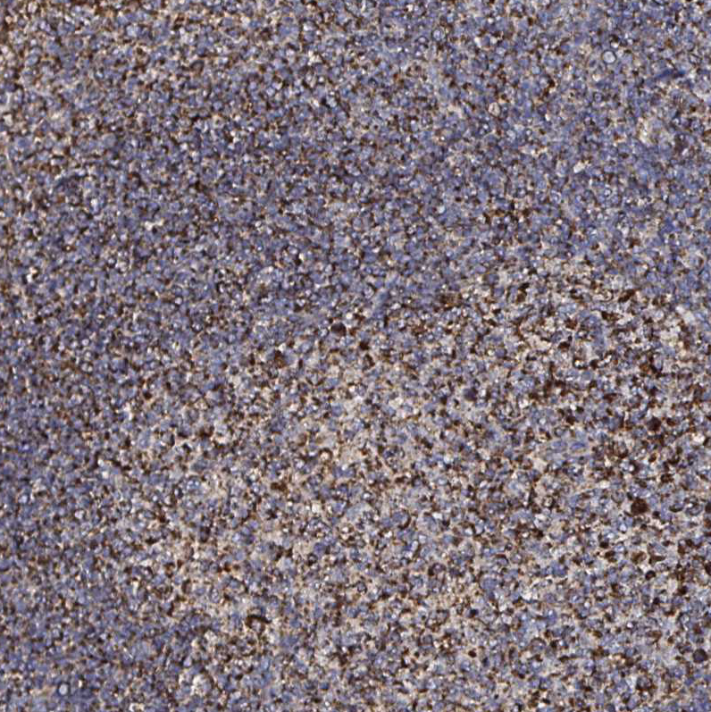 Anti-ATAD3B Antibody