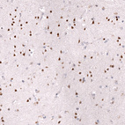 Immunohistochemical staining of human cerebral cortex shows strong nuclear positivity in neurons.