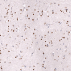 Anti-ZEB2 Antibody