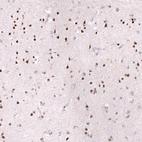 Immunohistochemical staining of human cerebral cortex shows strong nuclear positivity in neurons.