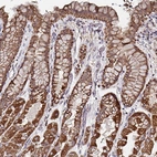 Immunohistochemical staining of human stomach shows strong granular cytoplasmic positivity in glandular cells.