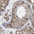 Immunohistochemical staining of human testis shows moderate to strong granular cytoplasmic positivity in cells in seminiferous ducts and Leydig cells.