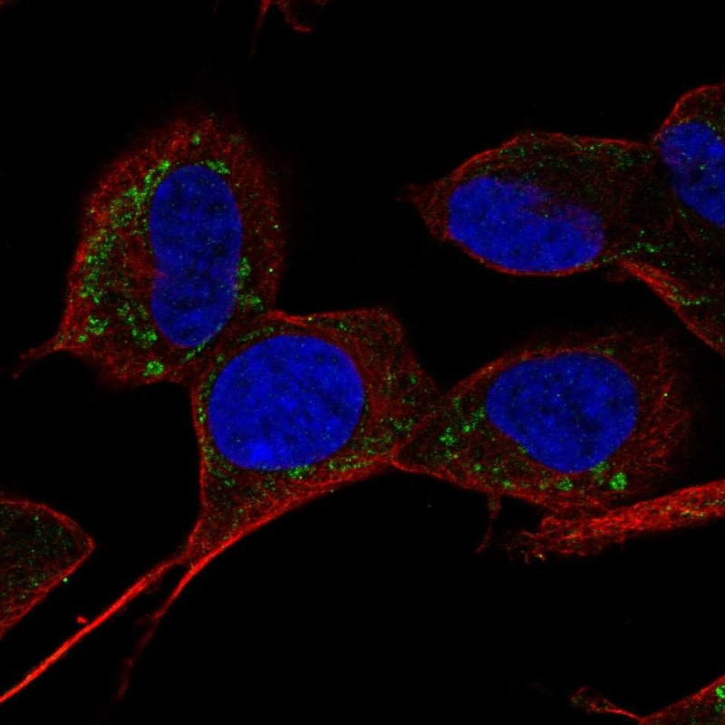 Anti-SLC9B1 Antibody