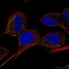 Anti-SLC9B1 Antibody