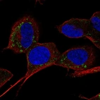 Anti-SLC9B1 Antibody