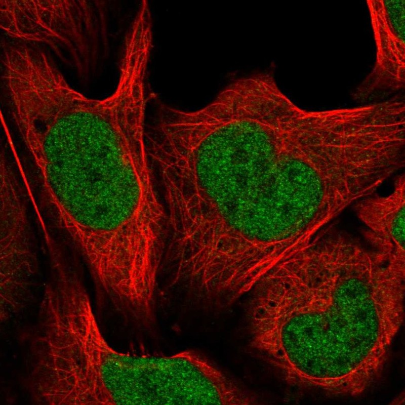 Anti-CUL4B Antibody