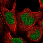 Anti-CUL4B Antibody