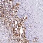 Anti-LHFP Antibody