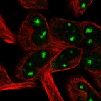 Immunofluorescent staining of human cell line RH-30 shows localization to nucleoli.