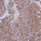 Immunohistochemical staining of human pancreas shows low expression as expected.