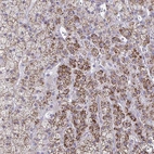 Anti-LRRC4B Antibody