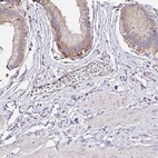 Anti-RSRP1 Antibody