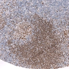 Immunohistochemical staining of human tonsil shows strong nuclear positivity in germinal center cells.