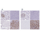 Anti-PITPNM3 Antibody