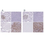 Immunohistochemical staining of human kidney, pancreas, skeletal muscle and spleen using Anti-PITPNM3 antibody HPA059005 (A) shows similar protein distribution across tissues to independent antibody HPA022432 (B).