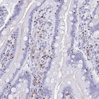 Immunohistochemical staining of human duodenum shows strong nuclear and cytoplasmic positivity in lymphoid cells.