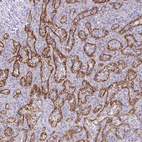 Immunohistochemical staining of human spleen shows strong membranous positivity in sinusoids.