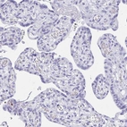 Immunohistochemical staining of human placenta shows negative positivity in trophoblastic cells as expected.