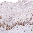 Immunohistochemical staining of human cervix shows strong nuclear positivity in squamous epithelial cells.