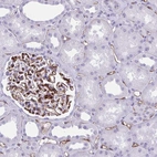 Immunohistochemical staining of human kidney shows strong membranous positivity in cells in glomeruli.