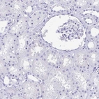 Immunohistochemical staining of human kidney shows negative positivity in cells in tubules and cells in glomeruli as expected.