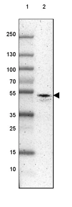 Lane 1: Marker [kDa] 250, 130, 100, 70, 55, 35, 25, 15, 10_br/_Lane 2: Human cell line SK-MEL-30