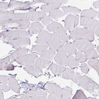Immunohistochemical staining of human skeletal muscle shows no positivity in myocytes as expected.