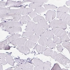 Immunohistochemical staining of human skeletal muscle shows no positivity in myocytes as expected.