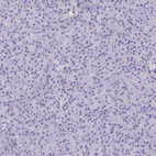 Anti-PITPNM3 Antibody