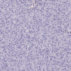 Immunohistochemical staining of human pancreas shows no positivity in exocrine glandular cells as expected.