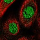 Anti-CHRAC1 Antibody