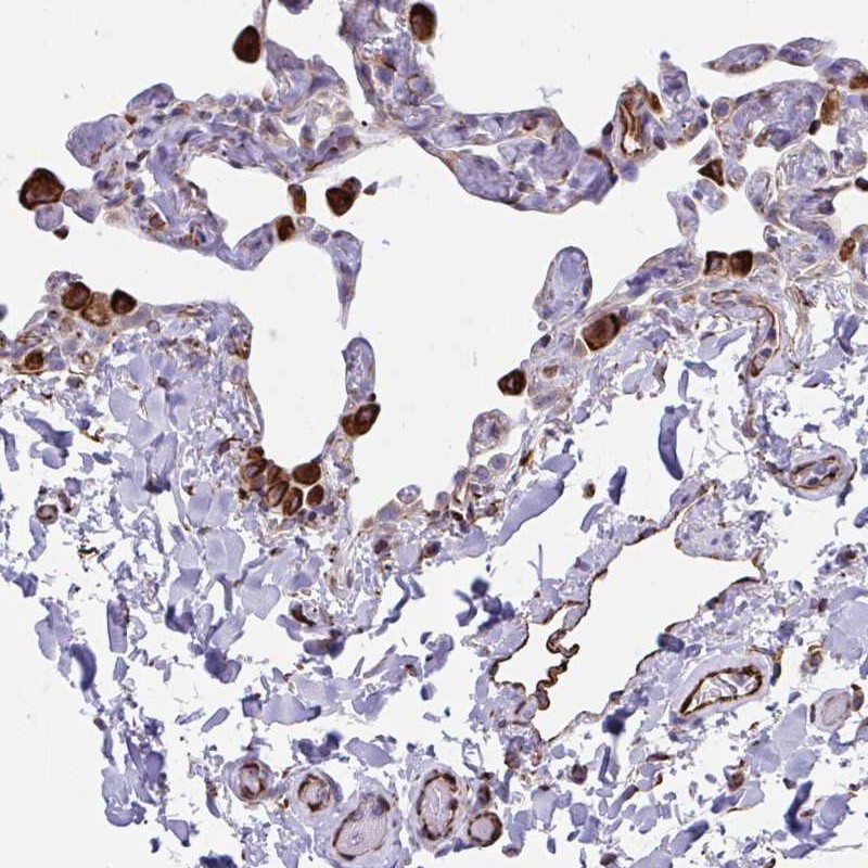 Anti-CACNG3 Antibody