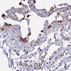 Anti-CACNG3 Antibody