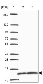 Lane 1: Marker [kDa] 250, 130, 95, 72, 55, 36, 28, 17, 10_br/_Lane 2: Human cell line RT-4_br/_Lane 3: Human cell line U-251MG sp