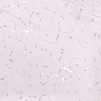 Immunohistochemical staining of human skeletal muscle shows no positivity in myocytes as expected.