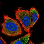 Immunofluorescent staining of human cell line PC-3 shows localization to nucleoli, cytosol & endoplasmic reticulum.