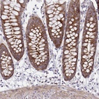 Anti-PPIH Antibody