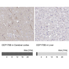 Anti-CEP170B Antibody