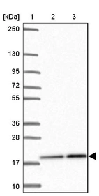 Lane 1: Marker [kDa] 250, 130, 95, 72, 55, 36, 28, 17, 10_br/_Lane 2: Human cell line RT-4_br/_Lane 3: Human cell line U-251MG sp