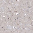 Immunohistochemical staining of human cerebral cortex shows high expression.