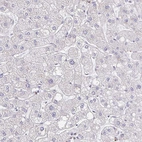 Immunohistochemical staining of human liver shows low expression as expected.