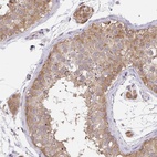 Anti-C19orf54 Antibody