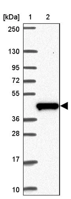Lane 1: Marker [kDa] 250, 130, 95, 72, 55, 36, 28, 17, 10_br/_Lane 2: Human cell line RT-4