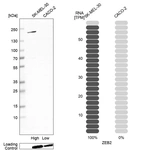 Western blot analysis in human cell lines SK-MEL-30 and Caco-2 using Anti-ZEB2 antibody. Corresponding ZEB2 RNA-seq data are presented for the same cell lines. Loading control: Anti-HDAC1.