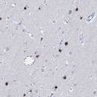 Anti-XAGE3 Antibody